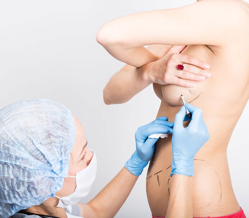breast-augmentation-img-CAPS-2022