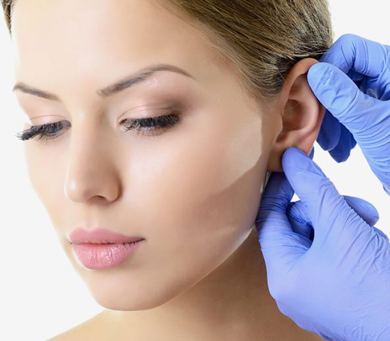 Otoplasty Ear Reshaping Surgery in Delhi