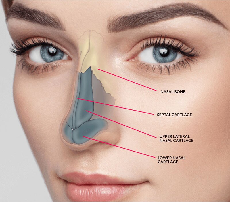 Rhinoplasty